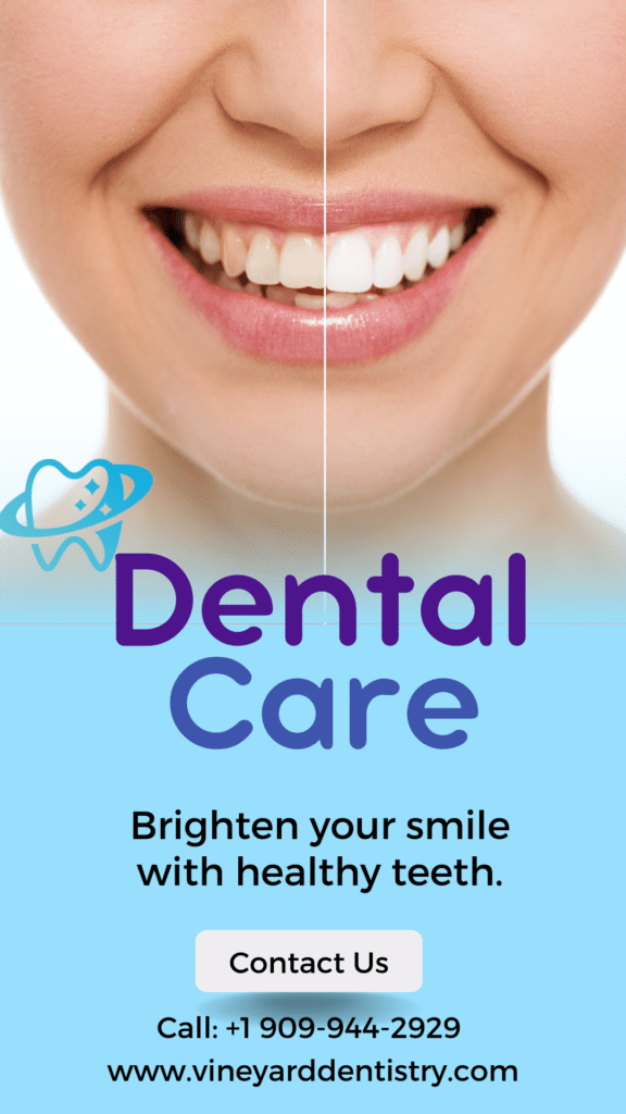 Teeth whitening